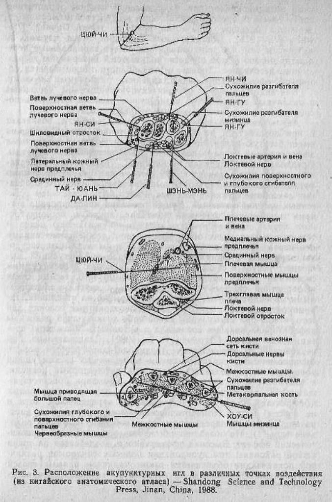 https://i4.imageban.ru/out/2023/06/18/258dcc9c07d9780d7ff219fa4f6a08bc.jpg